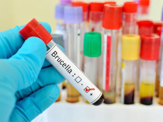 Alert for brucellosis patients in Ecuador